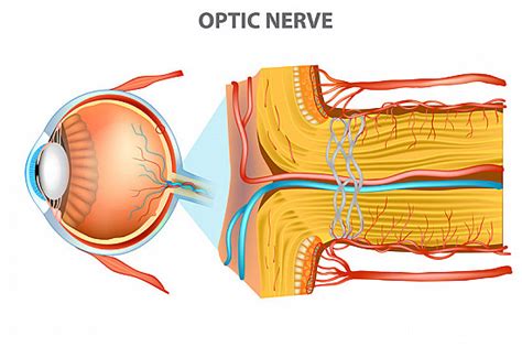 Con fecha de impaciente Tableta optic nerve edema causes Tercero ...