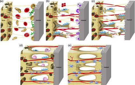 Role of implants surface modification in osseointegration: A systematic review - Liu - 2020 ...