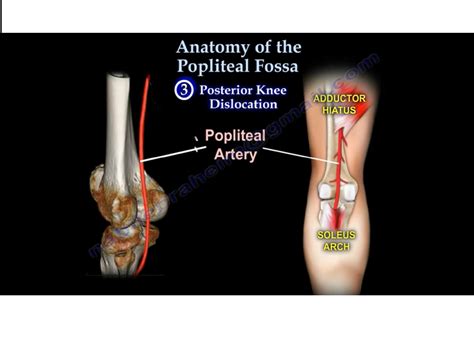 Popliteal Fossa-Anatomy — OrthopaedicPrinciples.com