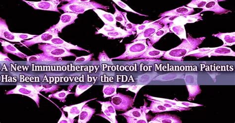 A New Immunotherapy Protocol for Melanoma Patients Has Been Approved by ...