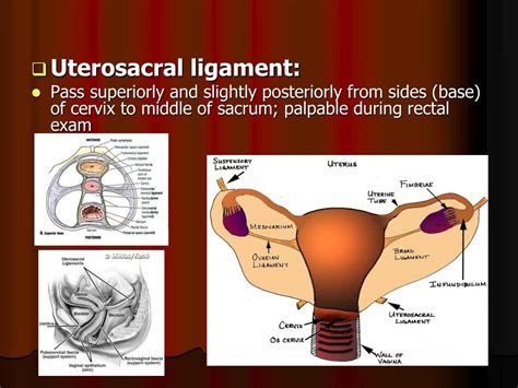 PPT - Genital prolapse PowerPoint Presentation - ID:737997