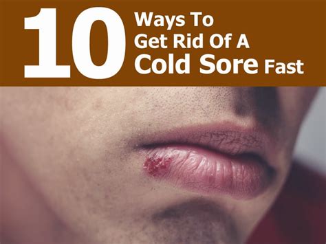 10 Ways To Get Rid Of A Cold Sore Fast - Handy DIY