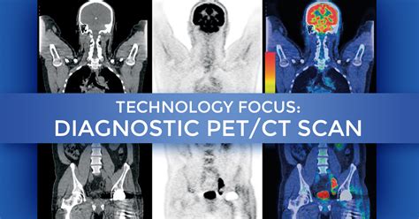 Technology Focus – Diagnostic PET/CT Scan at Summit Cancer Centers