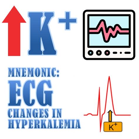 Hyperkalemia ECG Changes Mnemonic [With ECG Strips]