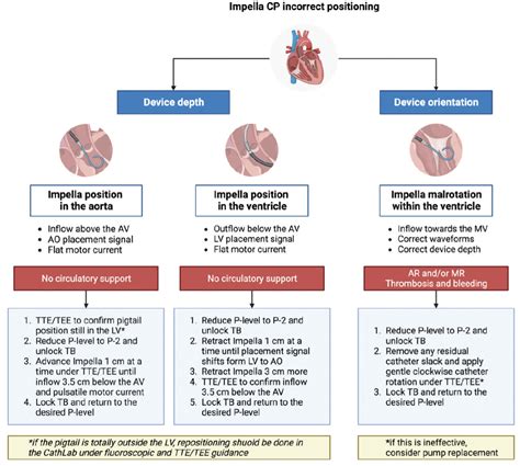 Technical Tips for Inserting and Positioning the Impella Device ...