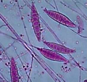 Fig. 16.2a: Spindle-shaped macroconidia, and microconidia, of Microsporum spp. [Reproduced by ...