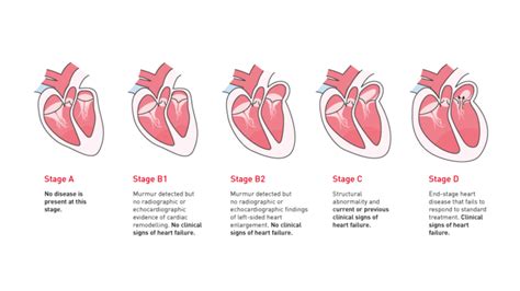 What Are The Stages Of Heart Failure In Dogs