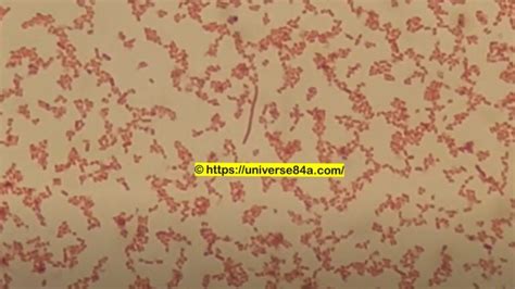 Enterobacter: Introduction, Morphology, Pathogenicity, Lab Diagnosis