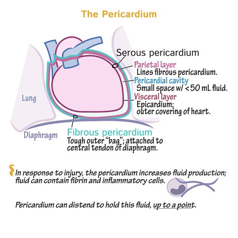 Pathology Glossary: Pericardial Diseases | Draw It to Know It