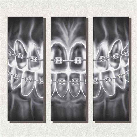 Art for Dentists - Braces X-Ray - Multi Panel Canvas Office Wall Art | Arte dental, Decoración ...