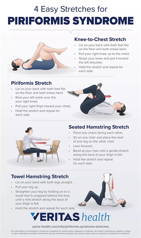 Piriformis Syndrome Pain Pattern