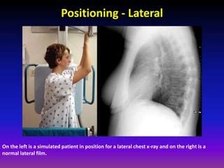 Fundamentals of chest radiology | PPT