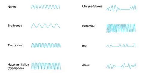 No Accepted Medical Uses: medicineisnotmerchandise: Breathing Patterns