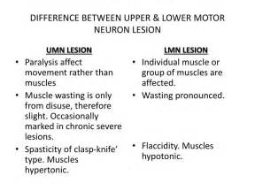 Upper Vs Lower Motor Neuron Signs