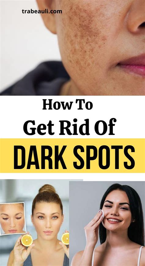 How To Get Rid Of Dark Spots Overnight With Home Remedies | Trabeauli | Dark spots on face ...