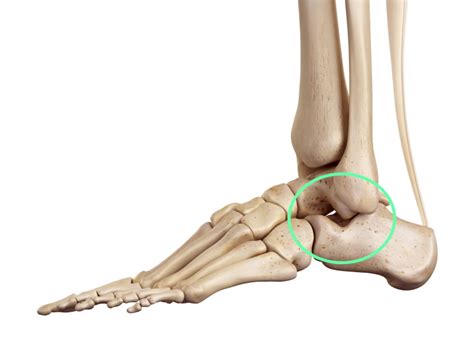 Sinus Tarsi Syndrome: A Comprehensive Guide - Sport Doctor London