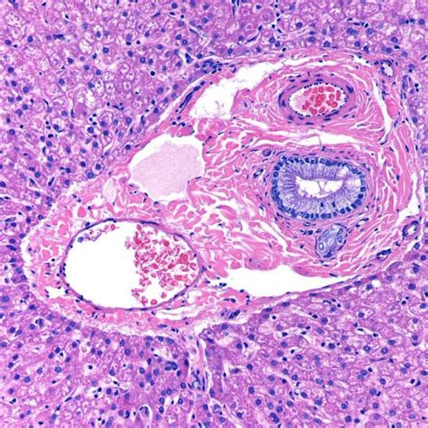 Histology - Liver - Portal Triad | Histology - Liver | Pinterest