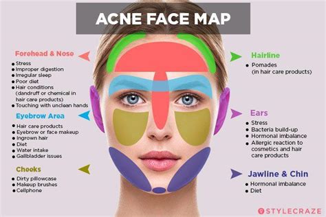 Mapa facial da acne: O que a sua acne está tentando dizer a você? - Bacana