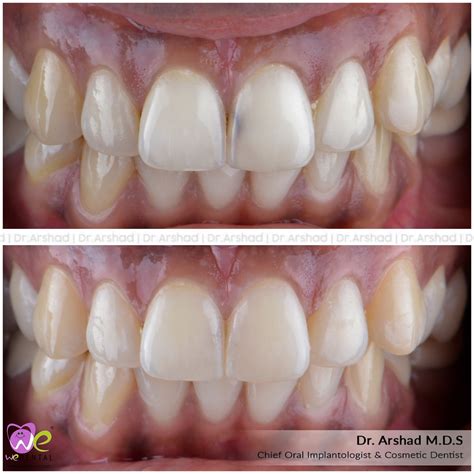 Dental services | Before & After