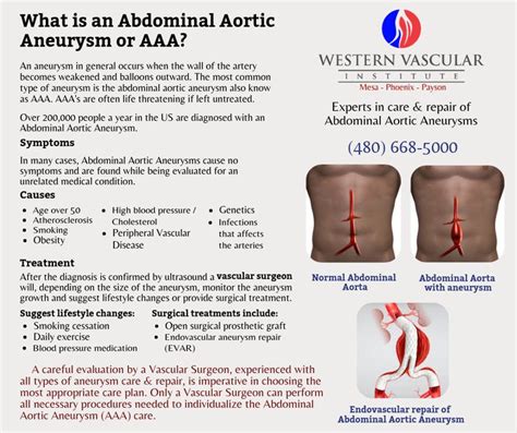 Pin by Christina Gehling on Job in 2021 | Aortic aneurysm, Abdominal aortic aneurysm, Aneurysm