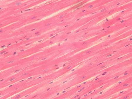 Cardiac muscle-intercalated discs | Cardiac, Recognition, Muscle tissue