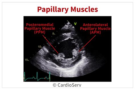 Finally... Mitral Valve Orientation Explained! Cardioserv