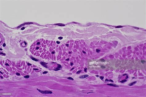 Visceral Peritoneum Histology