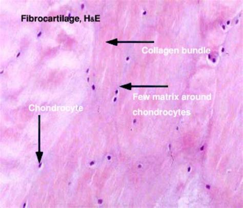 connective tissue cartilage