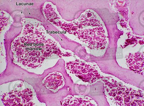 Mammal. Spongy osseous tissue. Femur. Transverse section. 125X - Spongy osseous tissue - Osseous ...