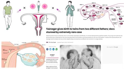 Heteroparental Superfecundation || Twins from two different fathers || - YouTube