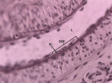 Simple Squamous Epithelium 40X - Annotated | Histology