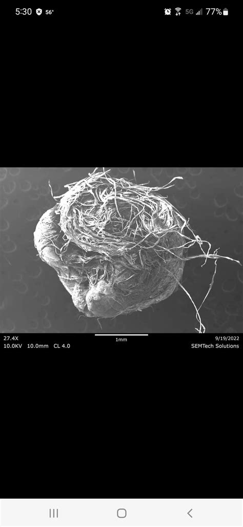 Kidney Stone in SEM : r/microscopy