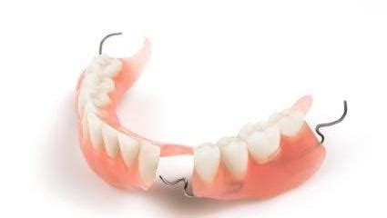 Gretna, LA Dentist | Partial Dentures Problems | Blog