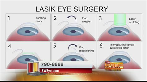 Southwestern Eye Center - Lasik Refractive Eye Surgery - YouTube