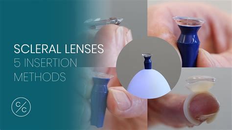 5 Insertion Methods for Scleral Lenses | Contacts with Conway - YouTube