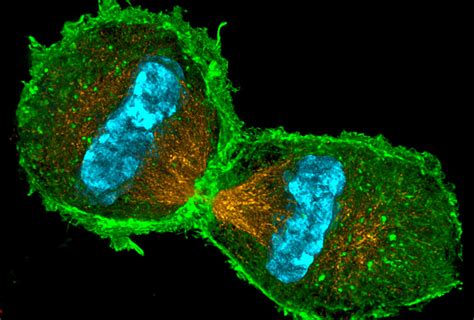 How do biomembranes form micro-structures in our cells? | Mathematical Institute