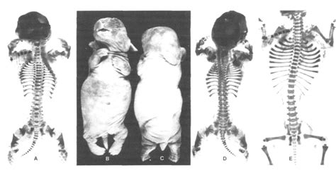 Table I from Hereditary chondrodystrophy in the rabbit. Genetics and pathology of a new mutant ...