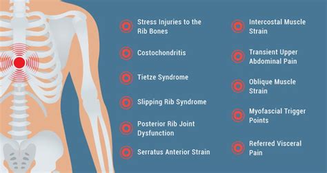 Getting to the Bottom of Rib Cage Pain - NYDNRehab.com