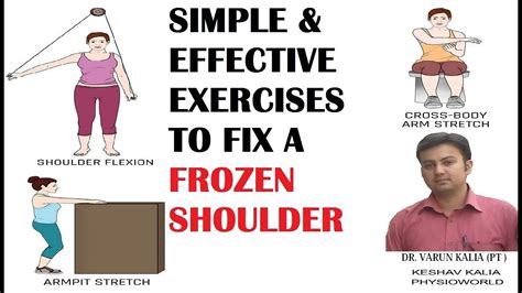 SIMPLE & EFFECTIVE EXERCISES TO FIX A FROZEN SHOULDER - YouTube