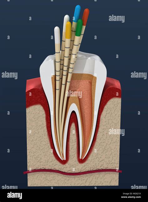 Gutta percha endodontics instrument, dental anatomy. 3D illustration Stock Photo - Alamy