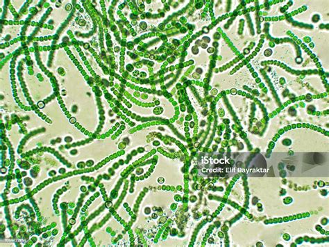 Nostoc Sp Algae Under Microscopic View Stock Photo - Download Image Now ...