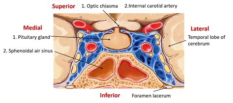 Cavernous Sinus – Anatomy QA