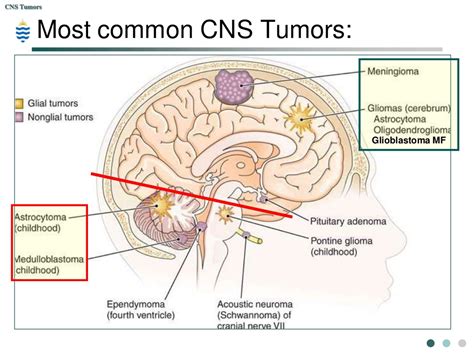 PPT - Pathology of CNS Tumors PowerPoint Presentation, free download ...