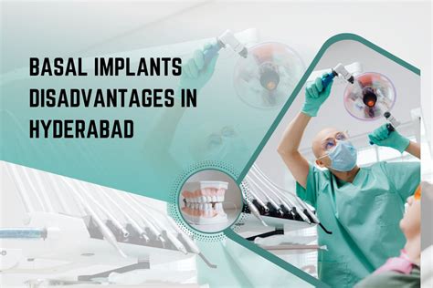 Basal Implants Disadvantages in Hyderabad - Smilebook Dental