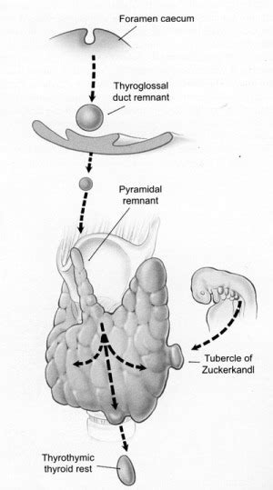 Thyroid Tissue