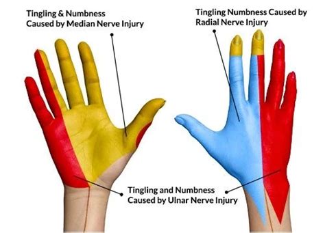 Most Common Reasons for Your Hands Going Numb