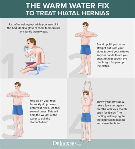 Hiatal Hernia: What it is and Natural Treatments - DrJockers.com Diy Remedies, Health Remedies ...