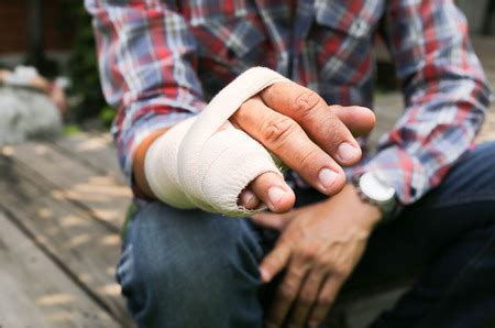 Treatment for a Broken Hand - Medical Experts