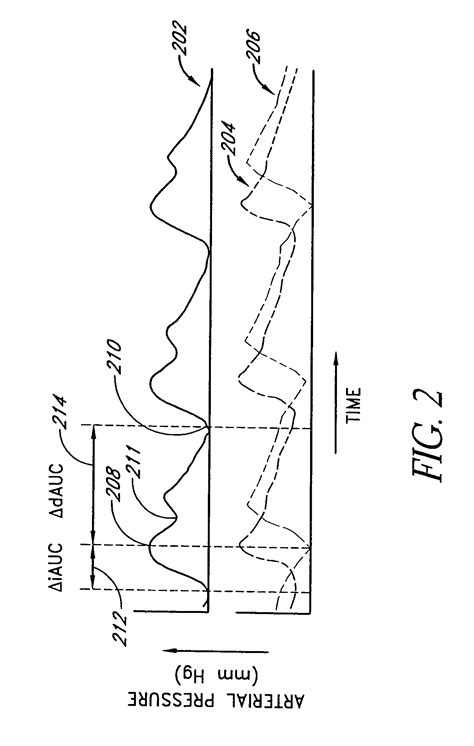 Patent US7044917 - Method and apparatus for measuring pulsus paradoxus - Google Patents