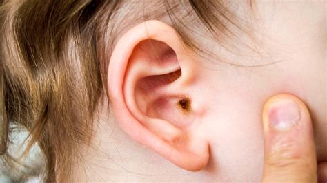 Ear Wax Draining From Toddler - Best Drain Photos Primagem.Org